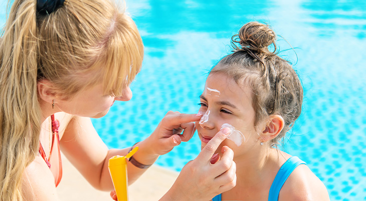 Zonnebrand voor kinderen